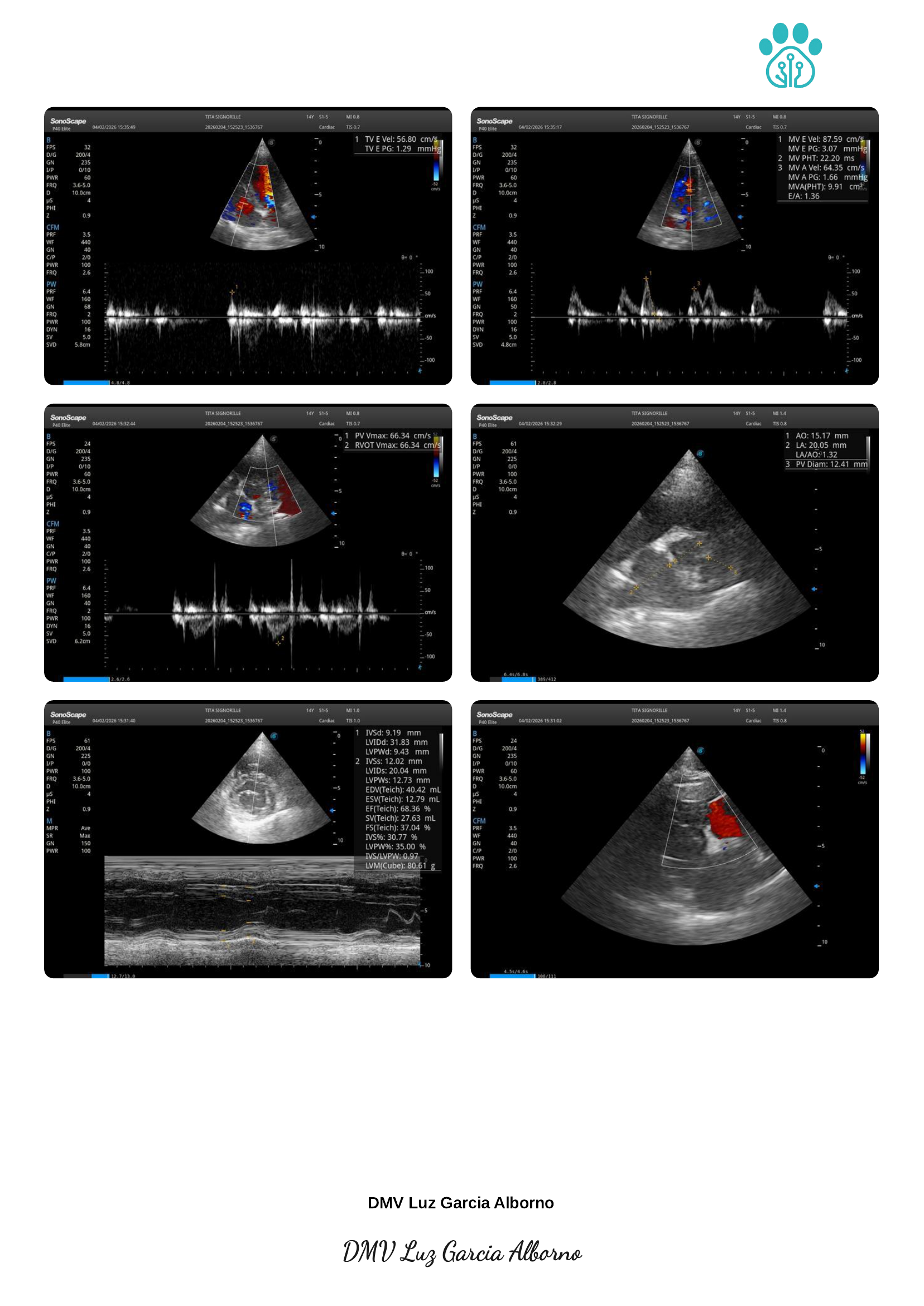 Echocardiography report page 5 of 5
